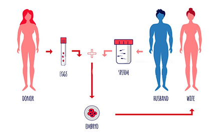 2. IVF with using fresh eggs from a donor.